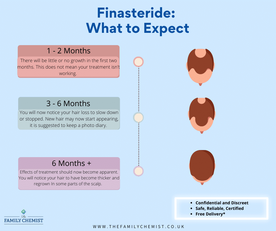 What to Expect With Finasteride