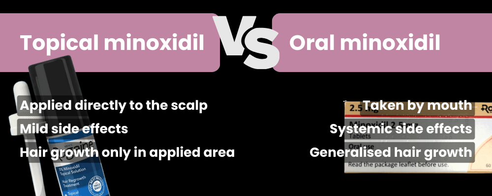 Oral minoxidil vs topical minoxidil infographic - Buy cheap oral minoxidil online