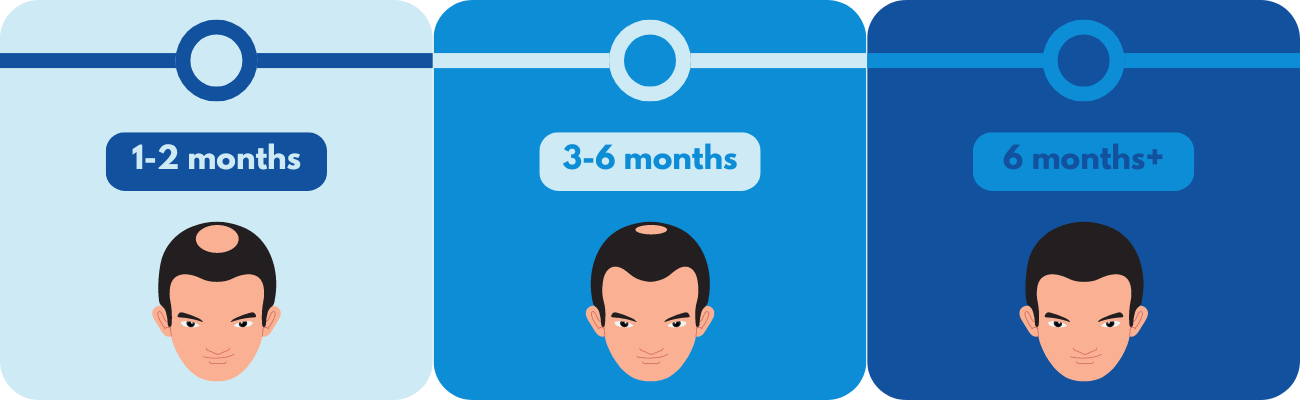 Finasteride timeline