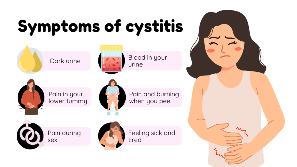 Can Cystitis Go Away On Its Own? | Buy Cystitis Treatment | TFC