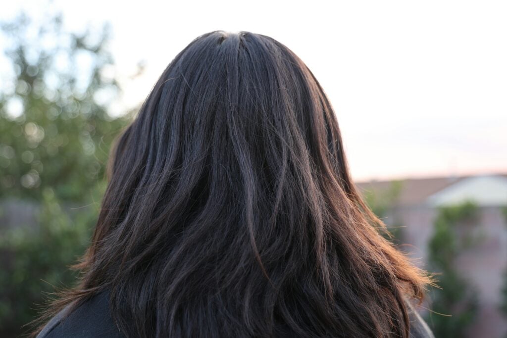 hair loss mounjaro