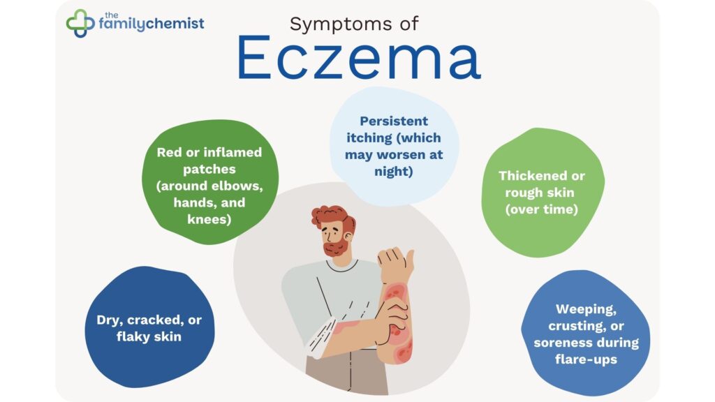 symptoms of eczema